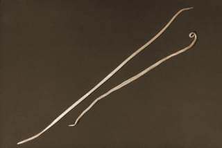 Two Ascaris lumbricoides nematods, i.e., roundworms. Photo credit: CDC Two Ascaris lumbricoides nematods, i.e., roundworms. Photo credit: CDC