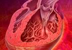 A practical guide to heart-failure diagnosis A practical guide to heart-failure diagnosis