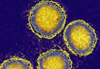 Hepatitis C: The Silent Epidemic Hepatitis C: The Silent Epidemic