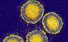Hepatitis C: The Silent Epidemic Hepatitis C: The Silent Epidemic