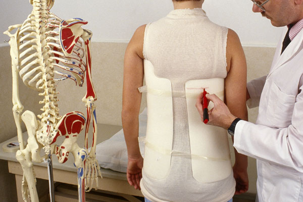 scoliosis-screening-in-schools-effective