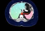 New strategies against obesity comorbidities New strategies against obesity comorbidities
