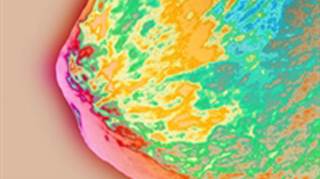 Navigating the evidence about cancer screening Navigating the evidence about cancer screening