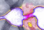 Understanding colon cancer screening tests Understanding colon cancer screening tests