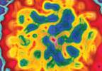 Demystifying the liver and its diseases Demystifying the liver and its diseases
