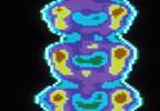 "Predisease": A concept whose time has come? "Predisease": A concept whose time has come?