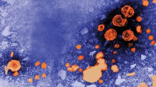 Treatment guidelines must expand to focus on patients co-infected with both HCV and HIV. Treatment guidelines must expand to focus on patients co-infected with both HCV and HIV.