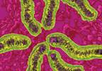 Helicobacter pylori: Toward effective eradication Helicobacter pylori: Toward effective eradication