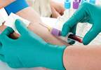 Tips for interpreting elevated hepatic enzymes Tips for interpreting elevated hepatic enzymes