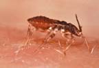 CDC: Chagas disease may be overlooked in newborns CDC: Chagas disease may be overlooked in newborns