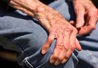 When is surgical intervention advisable for Parkinson disease? When is surgical intervention advisable for Parkinson disease?