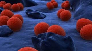 Neisseria gonorrhoeae Neisseria gonorrhoeae