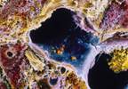 What to do with a positive hepatitis C test What to do with a positive hepatitis C test