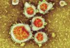 Managing infants with bronchiolitis Managing infants with bronchiolitis