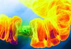 Obesity increases colorectal cancer risk in men Obesity increases colorectal cancer risk in men
