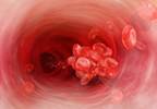 HEP Score useful for predicting heparin-induced thrombocytopenia HEP Score useful for predicting heparin-induced thrombocytopenia