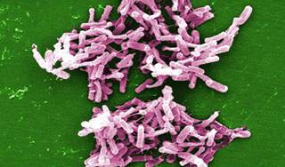 Many with <i>C. difficile</i> receive unnecessary antimicrobials Many with <i>C. difficile</i> receive unnecessary antimicrobials