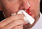 Should fatty liver be considered in spontaneous bleeding? Should fatty liver be considered in spontaneous bleeding?