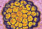Primary-care prevention of cervical cancer Primary-care prevention of cervical cancer