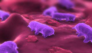 Pediatric Salmonella Typhimurium Outbreak Linked to Frogs Pediatric Salmonella Typhimurium Outbreak Linked to Frogs