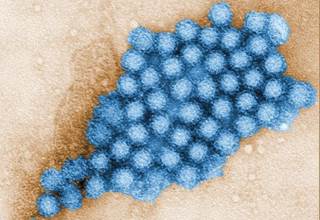 Norovirus leading offender in pediatric gastroenteritis Norovirus leading offender in pediatric gastroenteritis