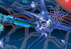 Alemtuzumab reduces MS relapses Alemtuzumab reduces MS relapses