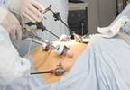 Bariatric surgery may reduce type 2 diabetes in obese patients Bariatric surgery may reduce type 2 diabetes in obese patients