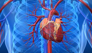 Azithromycin not linked to CV risk in Danish study Azithromycin not linked to CV risk in Danish study