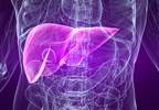 When to refer hepatitis C patients for specialist treatment When to refer hepatitis C patients for specialist treatment