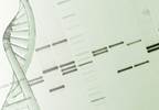Parkinson's gene therapy improves motor function Parkinson's gene therapy improves motor function