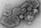 H7N9 bird flu resistant to oseltamivir H7N9 bird flu resistant to oseltamivir