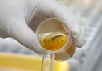 Quantifying proteinuria Quantifying proteinuria