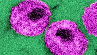 Healthcare worker HIV PEP guidelines updated Healthcare worker HIV PEP guidelines updated