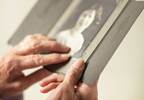 Famous faces test IDs young-onset dementia Famous faces test IDs young-onset dementia