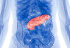 Obesity linked to worse survival in pancreatic CA Obesity linked to worse survival in pancreatic CA