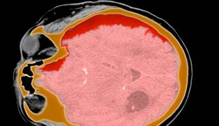 Minimizing radiation risk from diagnostic imaging Minimizing radiation risk from diagnostic imaging