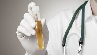 Method evaluating cells collected from urine shows 94% diagnostic accuracy. Method evaluating cells collected from urine shows 94% diagnostic accuracy.