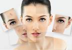 Minimally invasive acne Tx effective short term Minimally invasive acne Tx effective short term