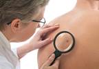 FDA approves melanoma combo treatment FDA approves melanoma combo treatment