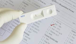 Direct-acting hep C antivirals effective without interferon Direct-acting hep C antivirals effective without interferon