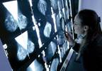 Women advised to undergo breast cancer risk assessment at 40 Women advised to undergo breast cancer risk assessment at 40