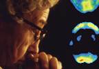 New tests to detect early Alzheimer disease New tests to detect early Alzheimer disease
