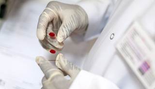 Achieving SVR reduces hep C treatment costs Achieving SVR reduces hep C treatment costs