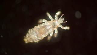 Resistant strain of head lice widespread in North America Resistant strain of head lice widespread in North America