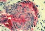 Prostate cancer data, dilemmas and decisions Prostate cancer data, dilemmas and decisions
