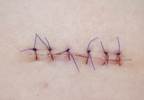 Leave children in stitches rather than tears Leave children in stitches rather than tears