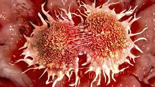 Prior to vaccine, most oropharyngeal cancers HPV+ Prior to vaccine, most oropharyngeal cancers HPV+