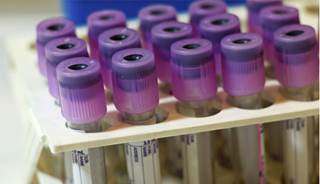 HIV-negative gay men are less likely to contract HIV with daily pre-exposure prophylaxis. HIV-negative gay men are less likely to contract HIV with daily pre-exposure prophylaxis.