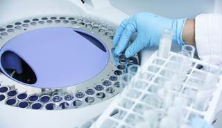 New testing technology closes gaps in HIV prevention efforts New testing technology closes gaps in HIV prevention efforts