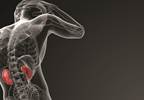 Chronic kidney disease linked to some cancers Chronic kidney disease linked to some cancers
